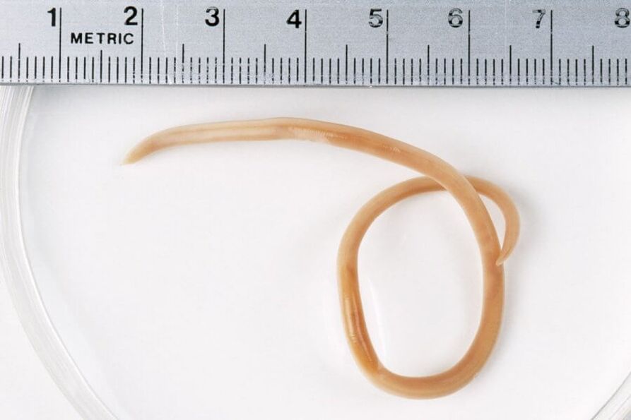 pinworm iz človeškega telesa