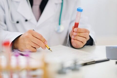 testi za parazite