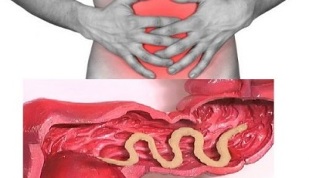 simptomi prisotnosti parazitov v človeškem črevesju